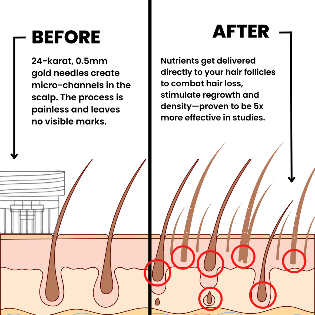 Innovex™ Hair Regrowth System