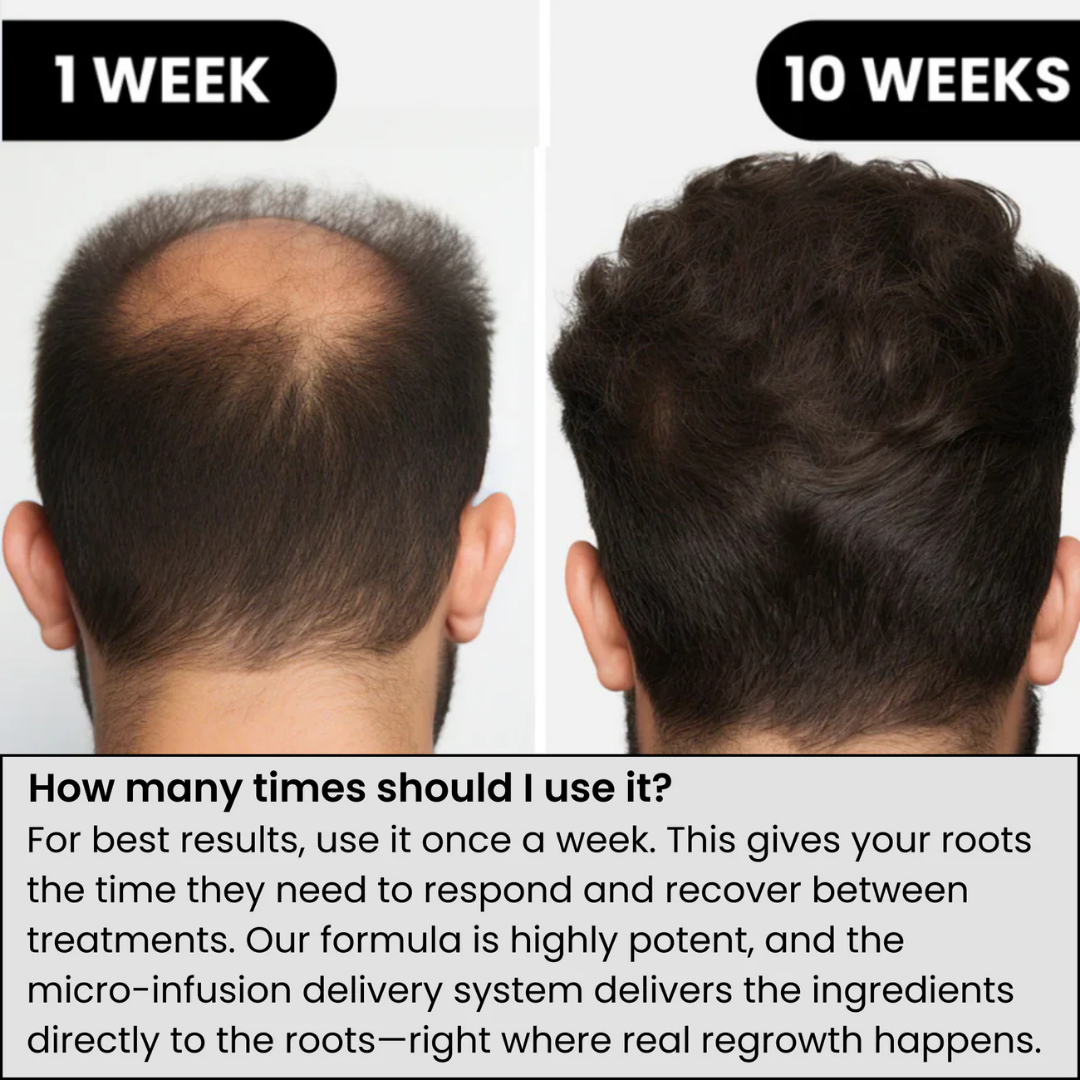 Innovex™ Hair Regrowth System